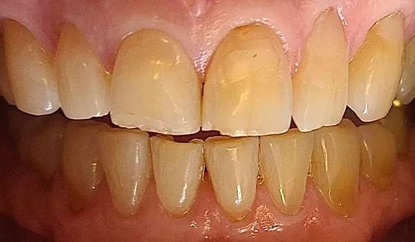 Before image