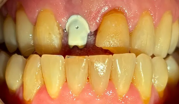 Before image