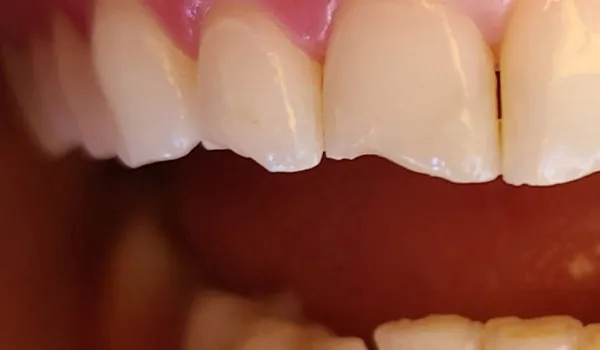 Before image