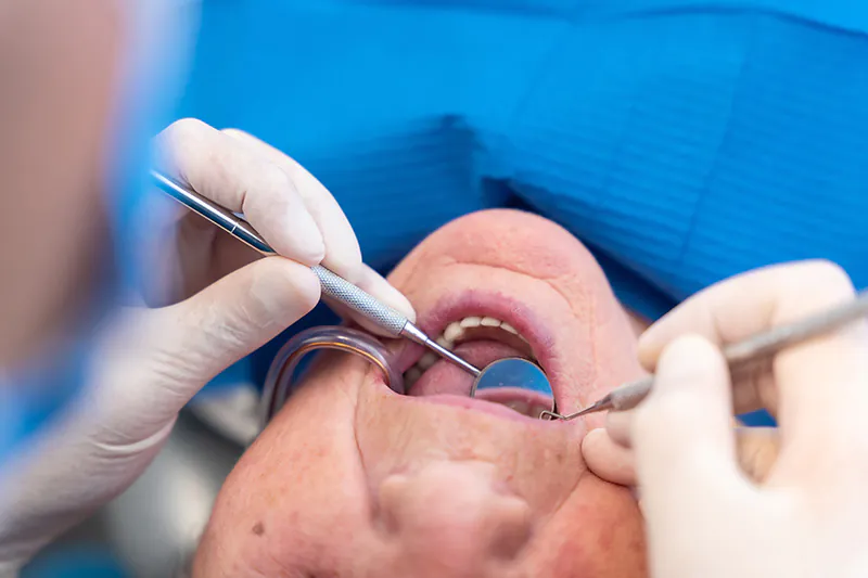 How Often Should You Visit the Dentist? 1 how often should you visit the dentist