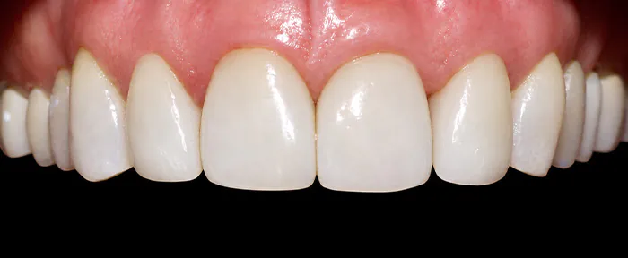 After image