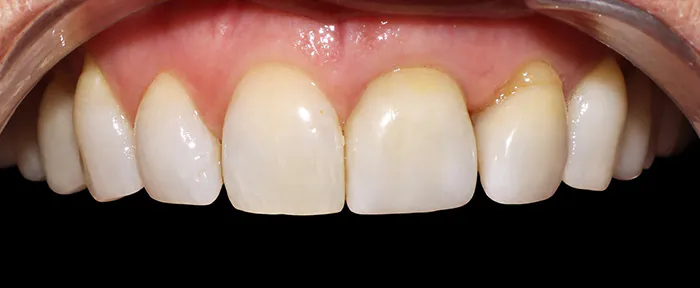 Before image